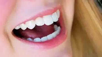 1571126179618862.jpg 1571126179618862.jpg